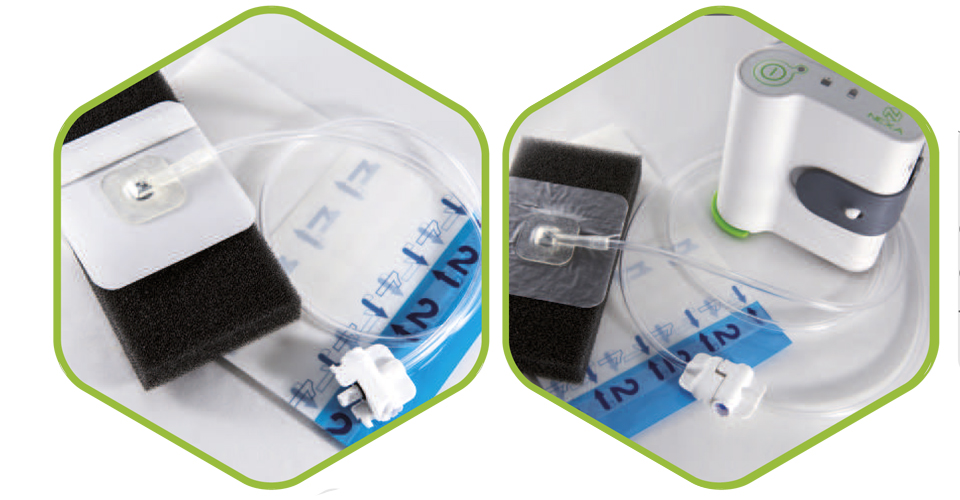 414-10-001 (A) Nexa Brochure - Product.indd