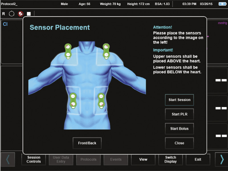 sensor